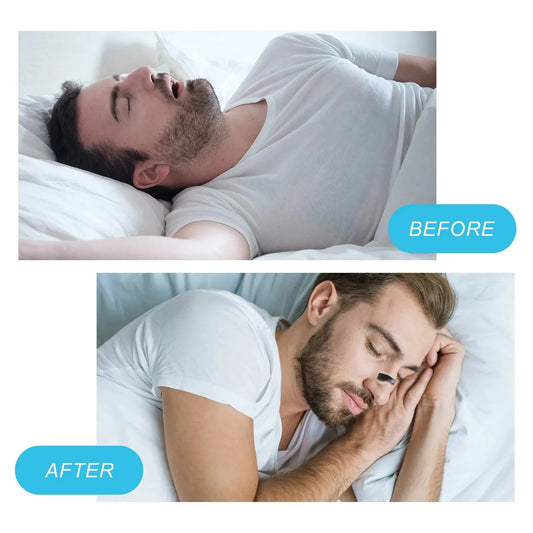 Sancta Magnetic Nasal Strips